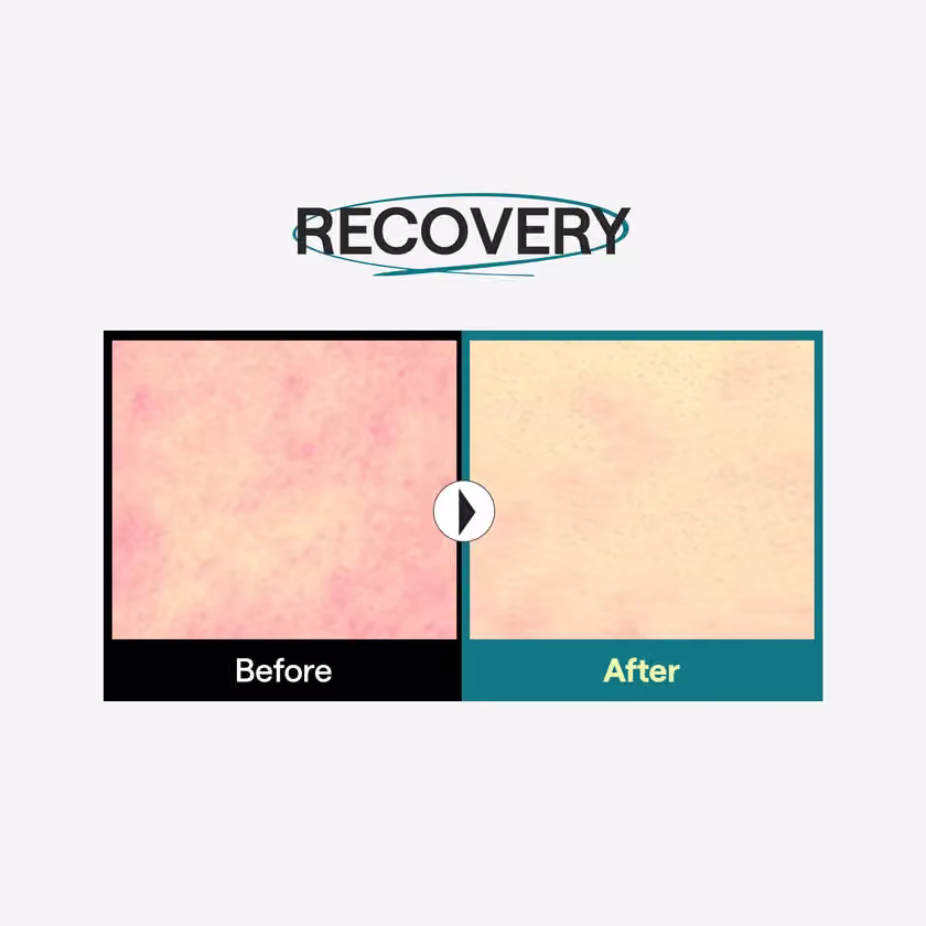 Brand before/after photograph for visible irritation after UV exposure.