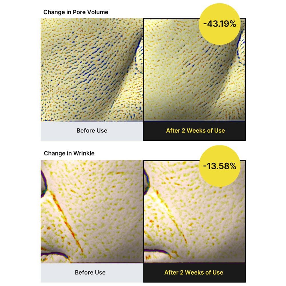 Two-week pore and wrinkle comparison; the pore-volume graphic says 43.19%.