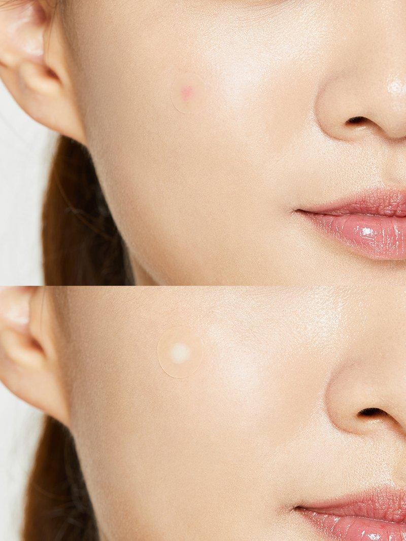 Patch appearance before and after absorbing fluid, shown on a model.