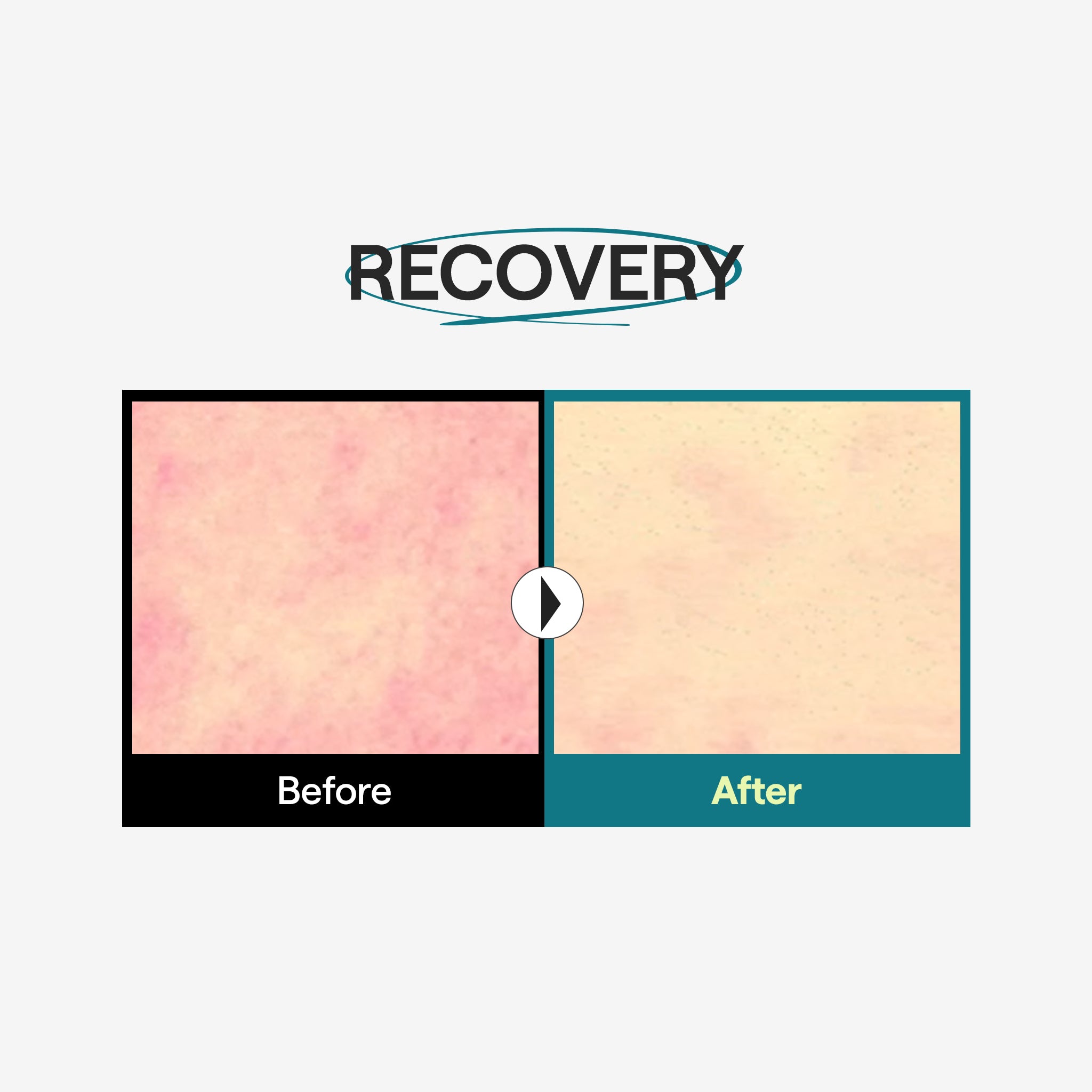 Brand before/after photograph for visible irritation after UV exposure.